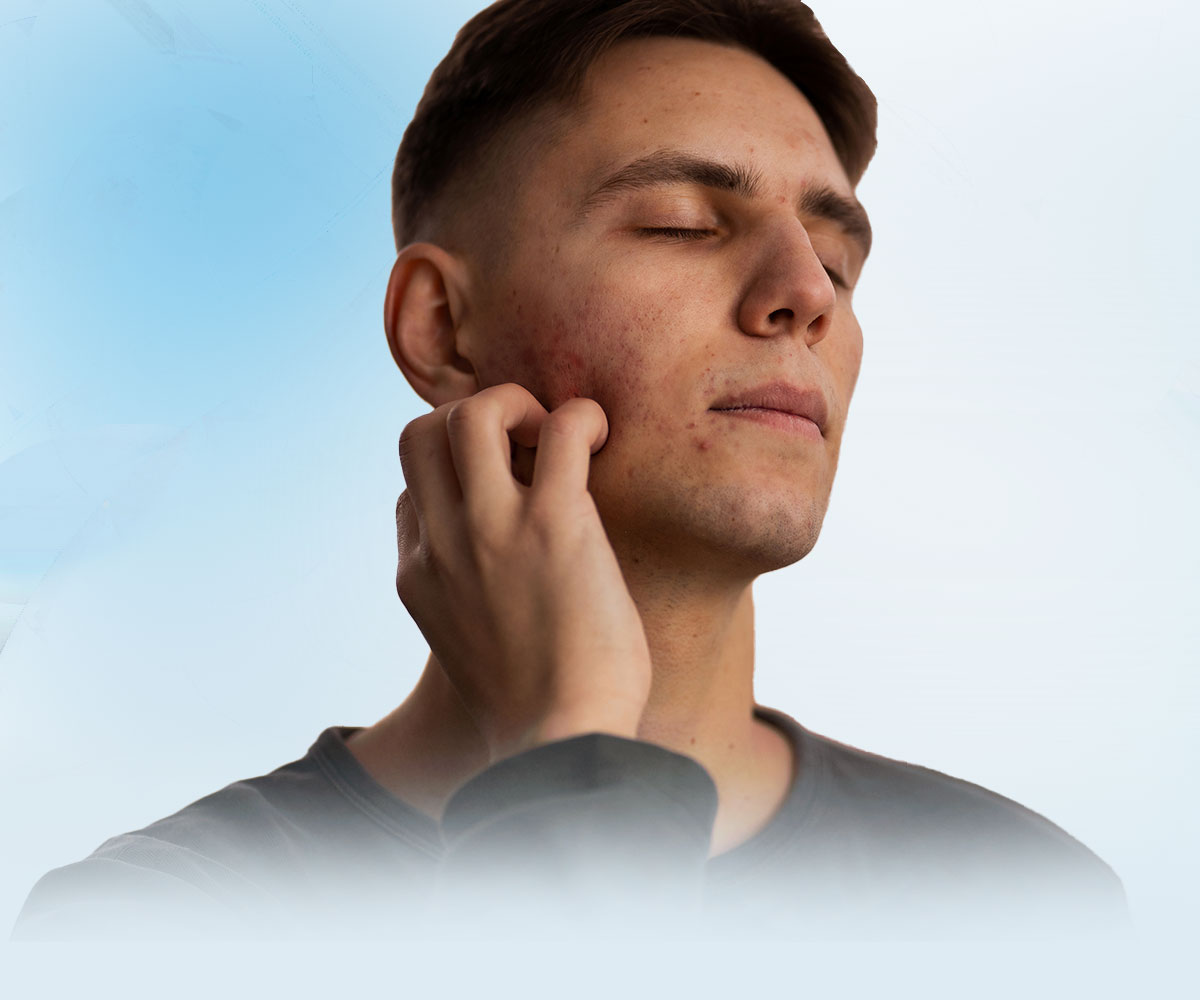 best psoriasis doctor in dhaka